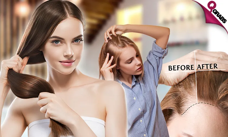 Ladies' Hair Treatments: Hair Loss, Dry Hair OR Anti-Dandruff!